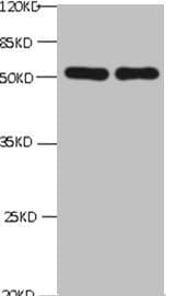 PathPlus™ Monoclonal Mouse anti-Human CHGA / Chromogranin A Antibody (IHC, WB)