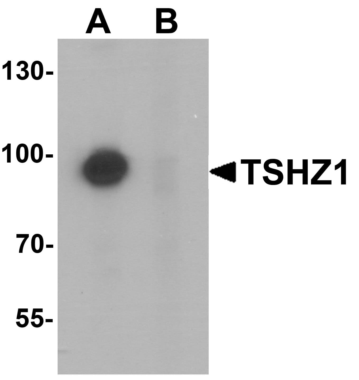 IHC-plus™ Polyclonal Rabbit anti-Human TSHZ1 Antibody (IHC, IF, WB)