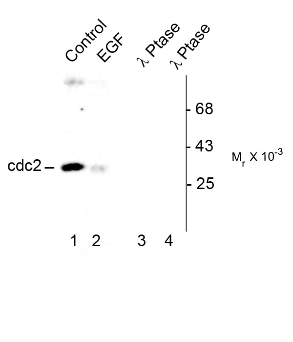 CDK1 / CDC2 Antibody (phospho-Tyr15)