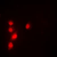 Polyclonal Rabbit anti-Human TIP49 / RUVBL1 Antibody (IHC, IF, WB)