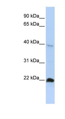 Polyclonal Rabbit anti-Human NKX3-2 / BAPX1 Antibody (aa251-300, WB)