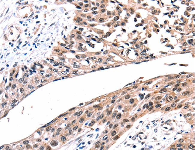 GJB2 / CX26 / Connexin 26 Antibody