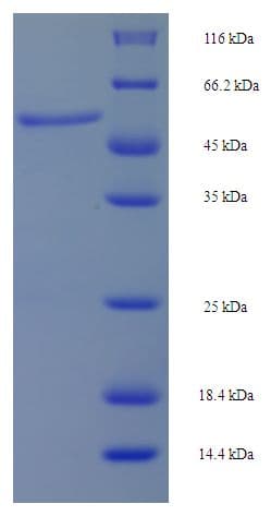 Human MAP2K6 / MEK6 / MKK6 Protein (Recombinant His-SUMO)