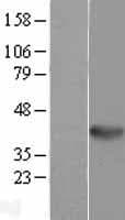 WNT5B Protein (Over-Expression Lysate Myc-DDK (Flag))