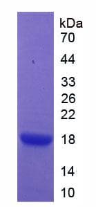 Human VG5Q / AGGF1 Protein (Recombinant His-T7)