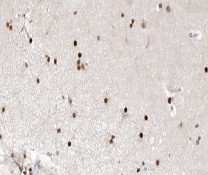 Polyclonal Rabbit anti-Human XRCC1 Antibody (IHC, WB)