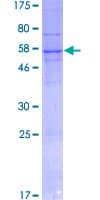 Human SGK494 Protein (Recombinant GST)