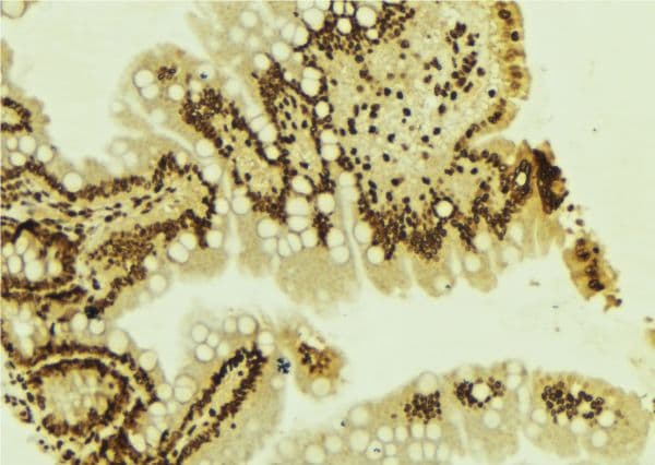 ZEB1 / AREB6 Antibody