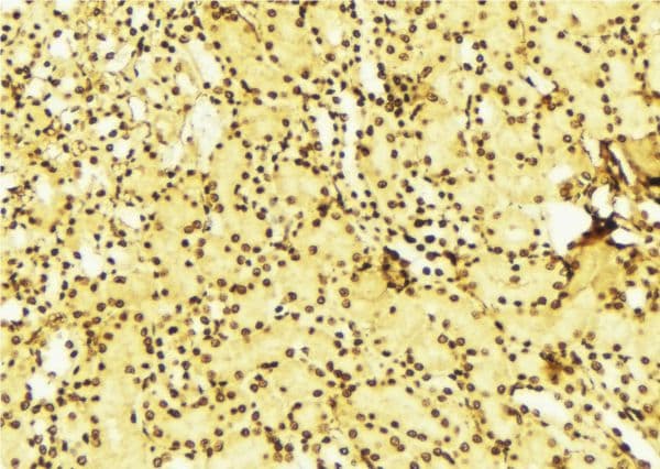 Polyclonal Rabbit anti-Human STK11 / LKB1 Antibody (IHC, IF, WB)