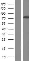 Human CACNB2 Protein (Over-Expression Lysate Myc-DDK (Flag))