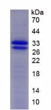 Mouse SOD3 Protein (Recombinant His, N-terminus)