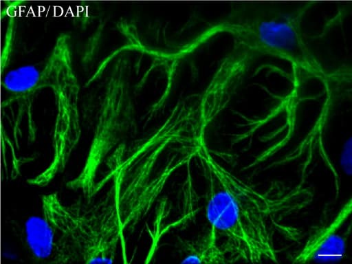 GFAP Antibody (clone UMAB5, Carrier-free)
