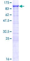 Human SCEL Protein (Recombinant GST)