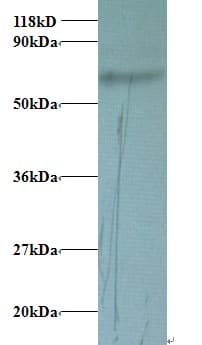 TF / Transferrin Antibody (FITC)