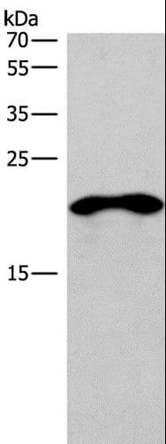 TNFRSF17 / BCMA Antibody