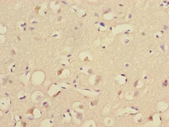 Polyclonal Rabbit anti-Human UBE2Z / USE1 Antibody (IHC, WB)