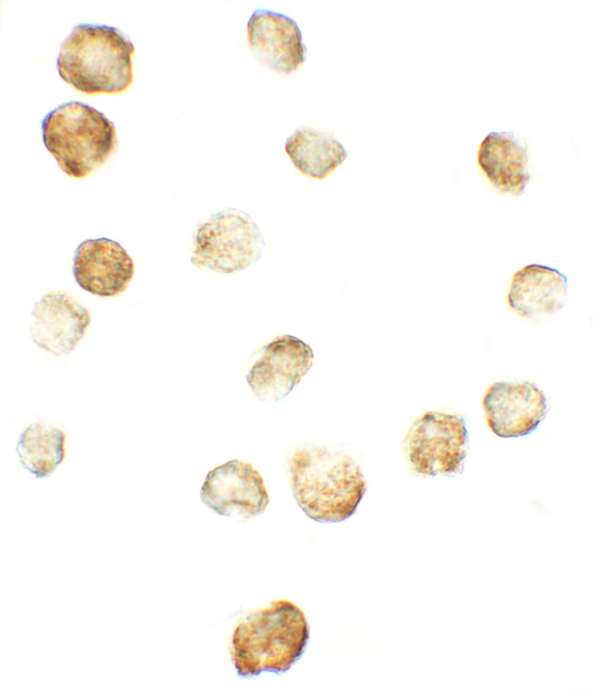 Polyclonal Rabbit anti-Human FKBP1A / FKBP12 Antibody (IF, WB)