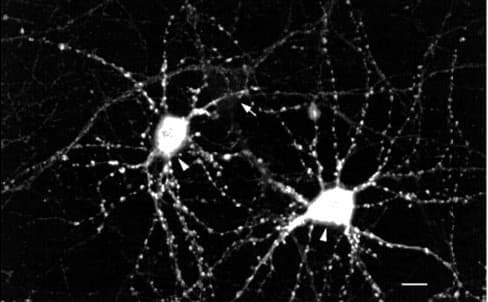 CAMK2 / CAMKII Antibody (phospho-Thr286/Thr287, clone 22B1)