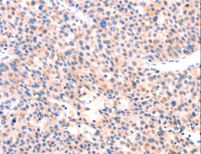 Polyclonal Rabbit anti-Human APBA2 Antibody (IHC)