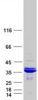 Human THG1L Protein (Recombinant Myc-DDK (Flag))