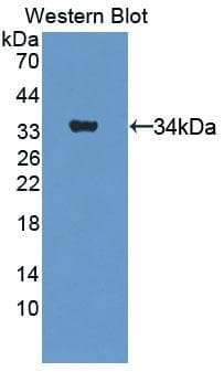 Complement C5a Antibody (aa678-751)