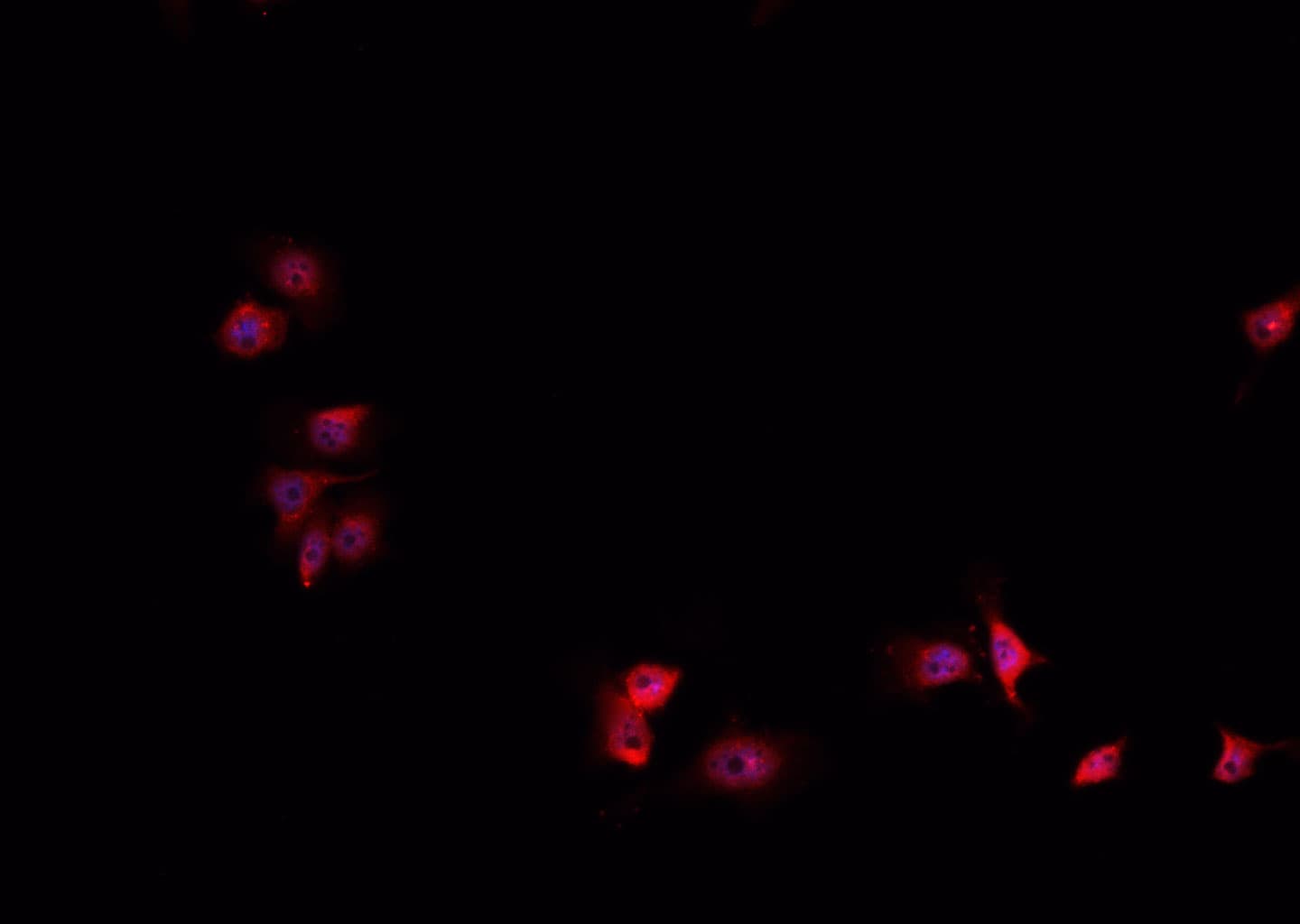 Polyclonal Rabbit anti-Human HIF1A / HIF1 Alpha Antibody (IHC, IF, WB)