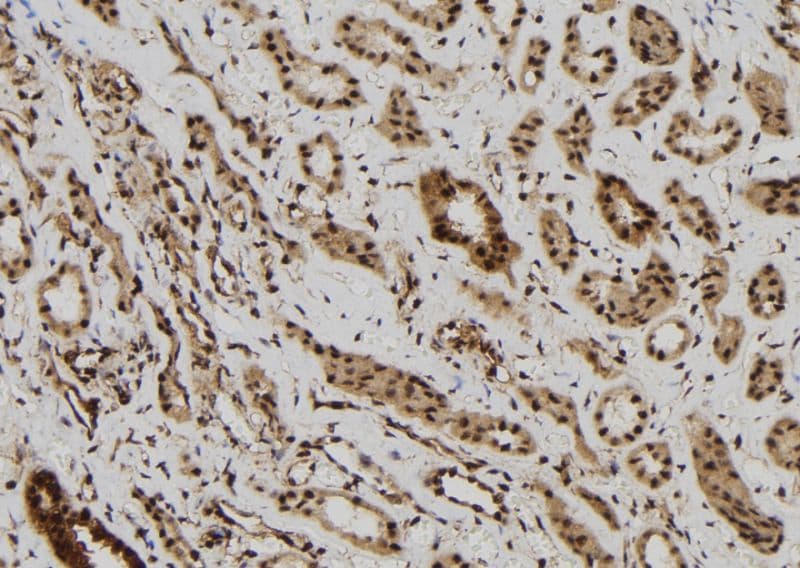 MAGEB6 Antibody