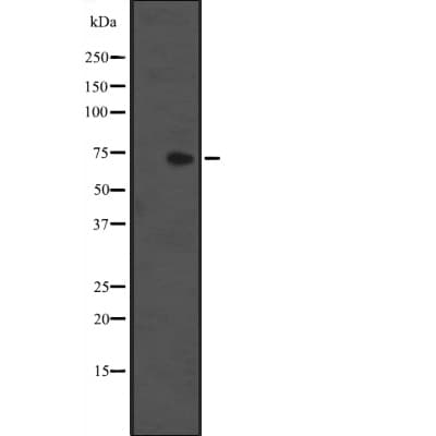 Polyclonal Rabbit anti-Human IL1RL1 Antibody (IHC, WB)