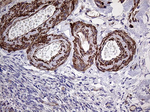TYW2 / TRMT12 Antibody (clone OTI1C9)