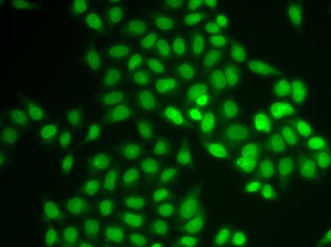 IHC-plus™ UEV1 / UEV1A Antibody
