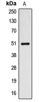 ALDH3A1 Antibody (Internal)