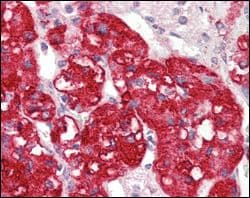 Monoclonal Mouse anti-Human STYK1 Antibody (clone 2H2F10, IHC, WB)