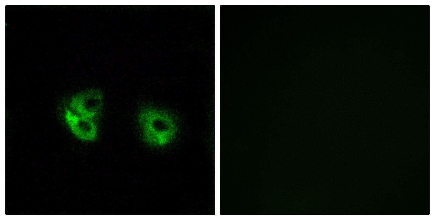 MARCH2 Antibody