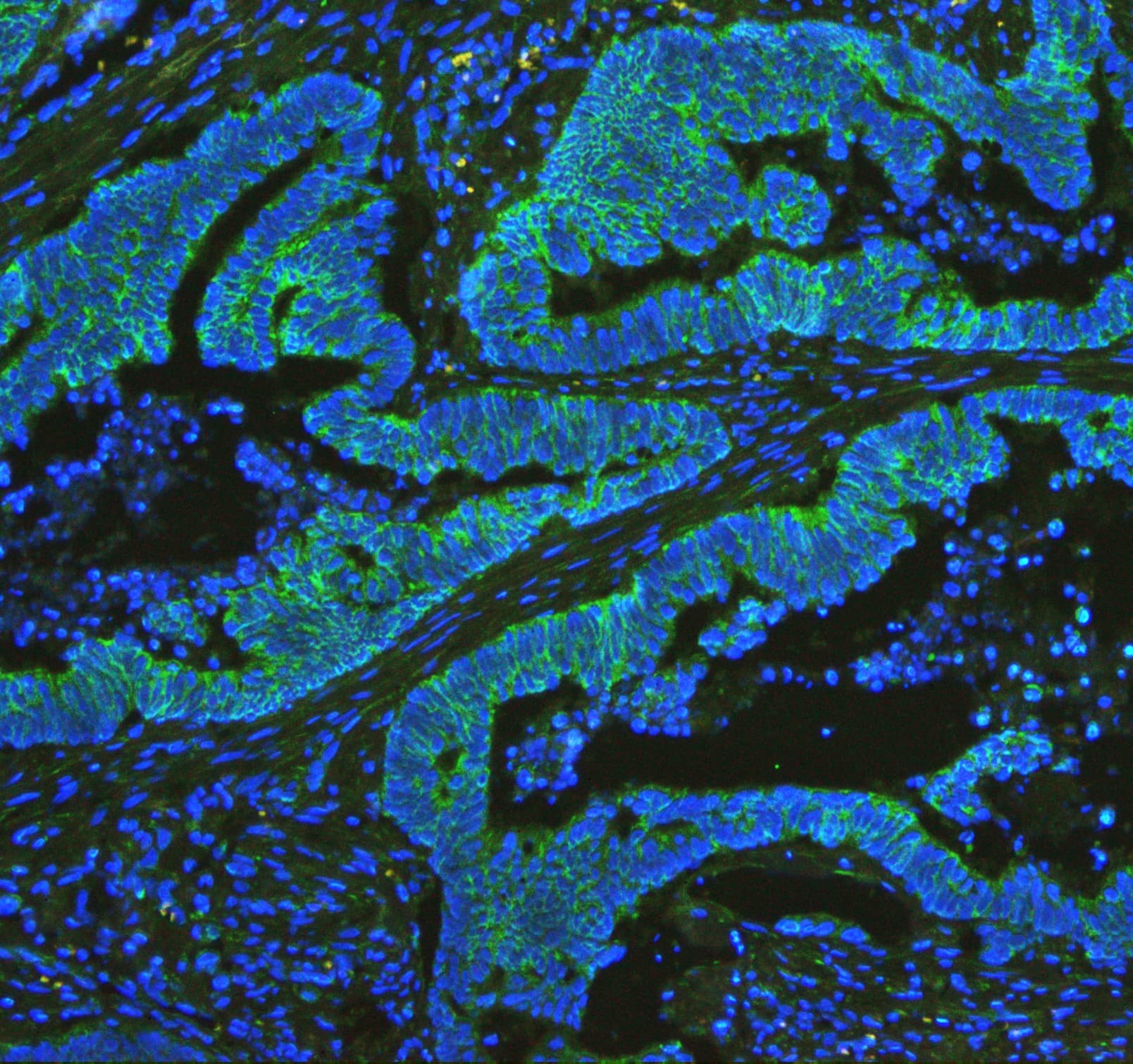 Polyclonal Rabbit anti-Human CYCS / Cytochrome c Antibody (aa2-105, IHC, WB)