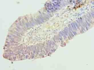 RINT1 Antibody