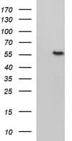 FGG / Fibrinogen Gamma Antibody (clone OTI4B8)