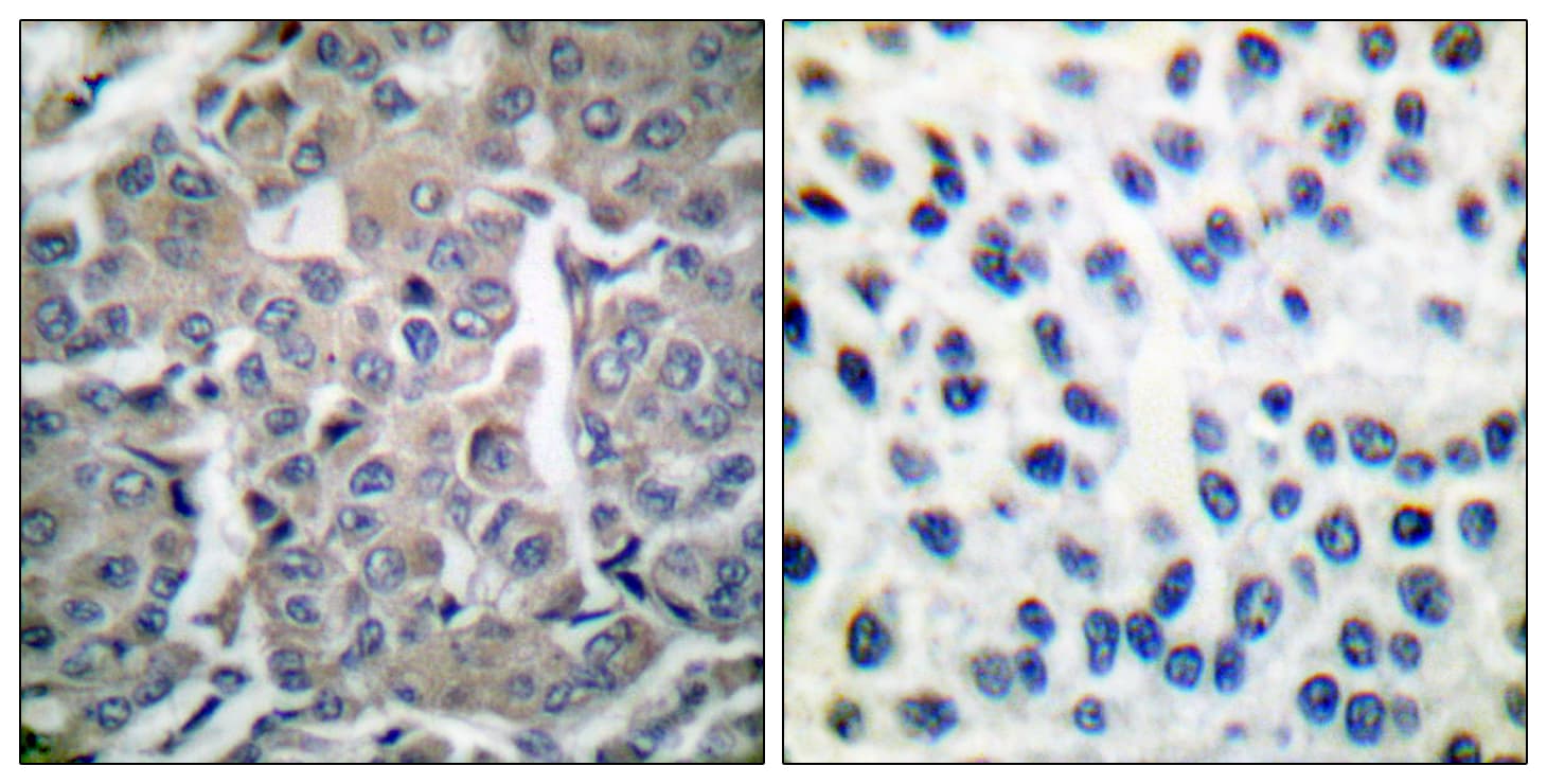 Polyclonal Rabbit anti-Human Acetyl-CoA Carboxylase / ACC Antibody (aa46-95, IHC, WB)