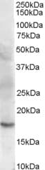 IHC-plus™ Polyclonal Goat anti-Human CFL2 / Cofilin 2 Antibody (aa142-152, IHC, WB)