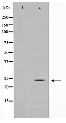 TIMP3 Antibody