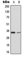 TNFAIP1 Antibody (Internal)