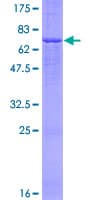 Human FADS3 Protein (Recombinant GST)