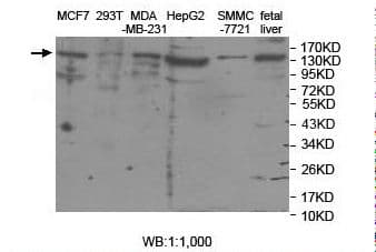 ASTN2 Antibody (aa134-321)