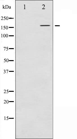 Polyclonal Rabbit anti-Human FANCD2 Antibody (phospho-Ser222, IHC, IF, WB)