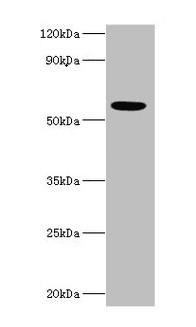 IFNAR2 Antibody (aa27-243)