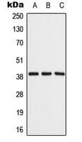 ALDOB Antibody (Internal)