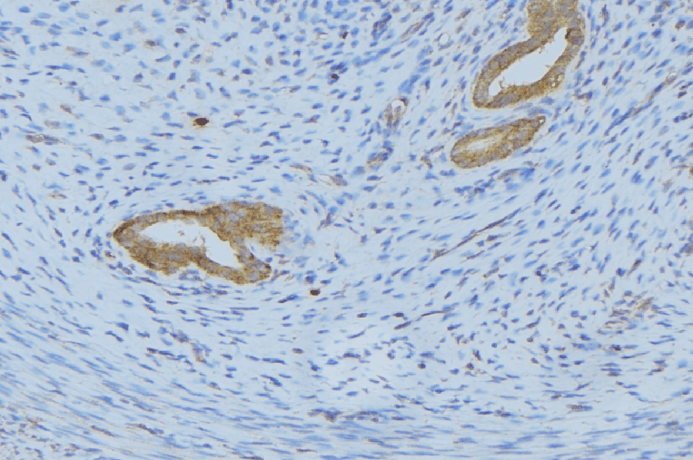 Polyclonal Rabbit anti-Human IL5 Antibody (IHC, WB)