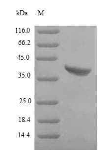 Staphylococcus aureus Gamma-hemolysin component B Protein (Recombinant 6His, N-terminus)