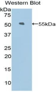 Polyclonal Rabbit anti-Rat Kinesin 5A / KIF5A Antibody (Cy3, aa823-1027, WB)