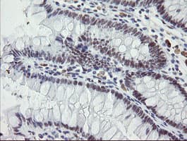 ZBED1 / TRAMP Antibody (clone OTI2A7)