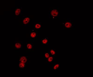 TCEB3C / Elongin A3 Antibody